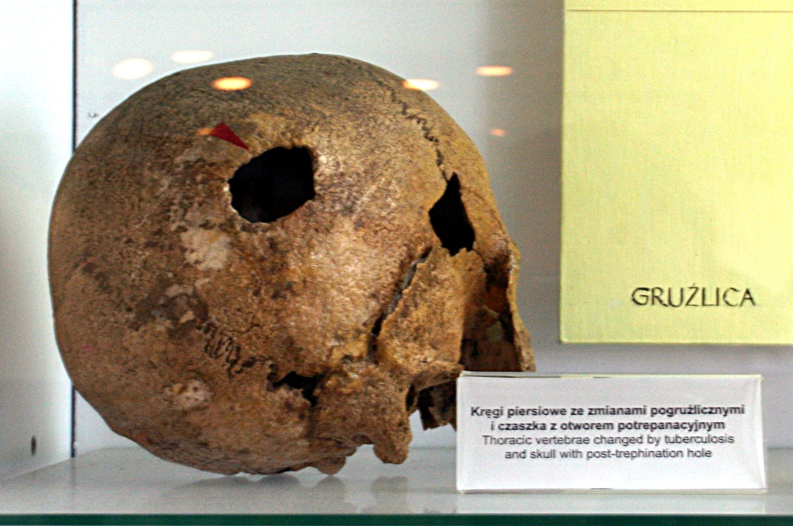 Archeological Museum in Gdańsk