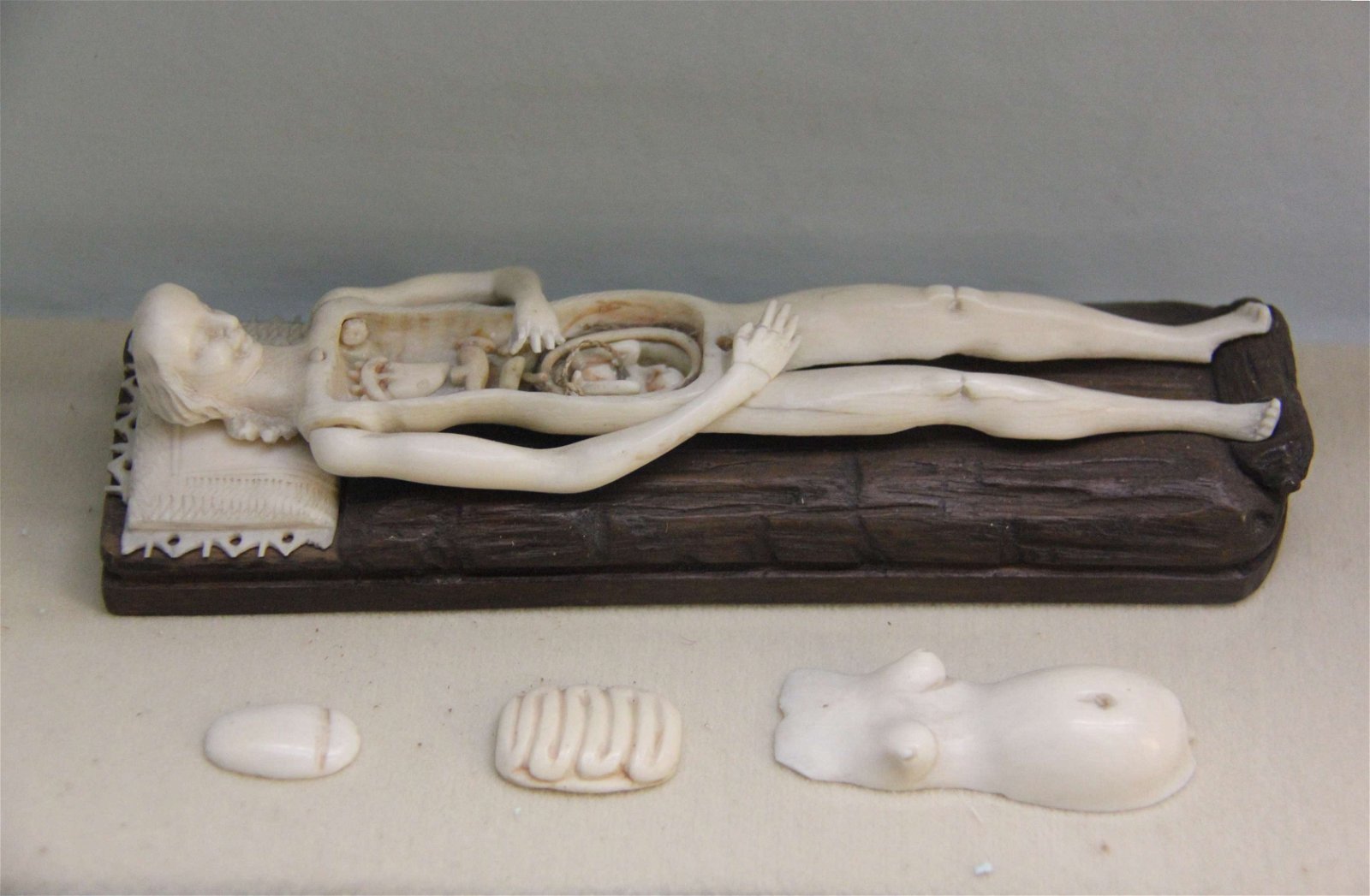 Semmelweis Museum of Medical History