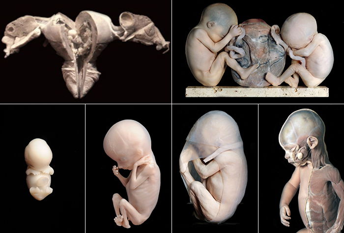 Museum voor Anatomie en Pathologie