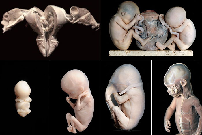 Museum voor Anatomie en Pathologie