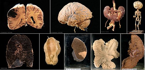 Museum voor Anatomie en Pathologie