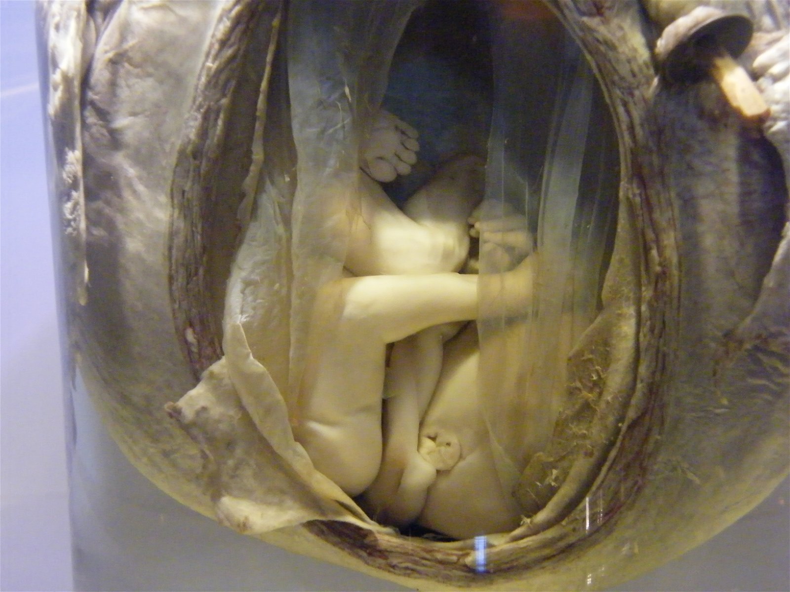 The Hunterian Museum and Art Gallery