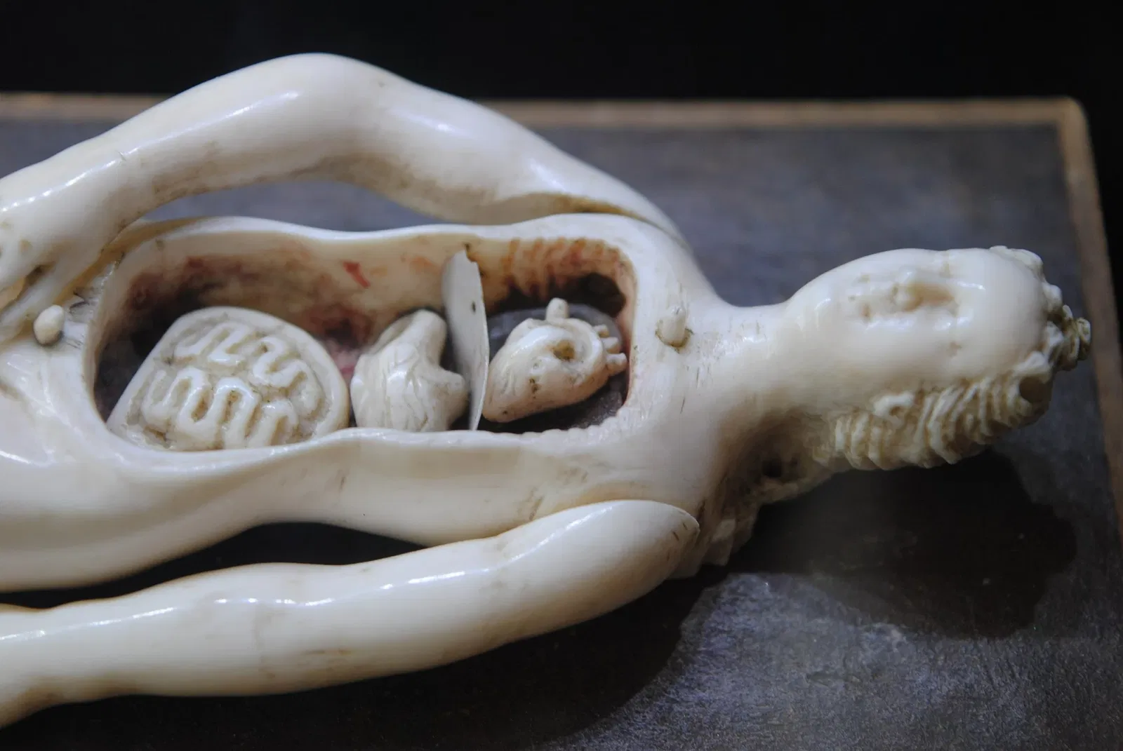 Dittrick Museum of Medicine History