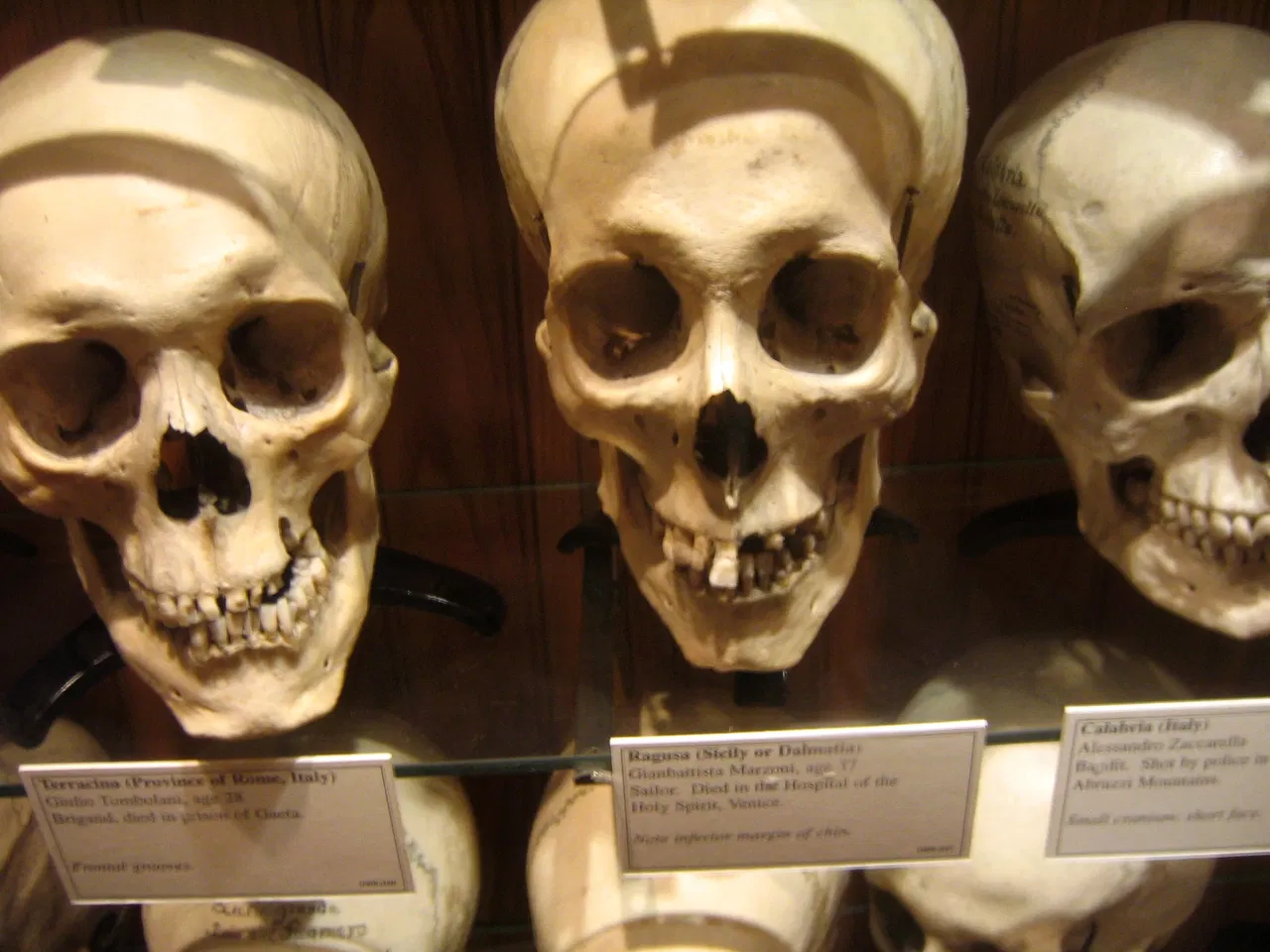 Mütter Museum (Philadelphia) - Visitor Information & Reviews