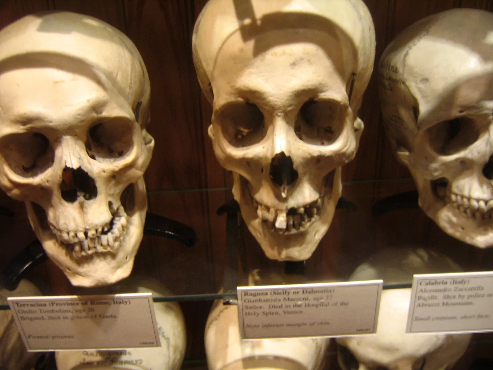 Mütter Museum