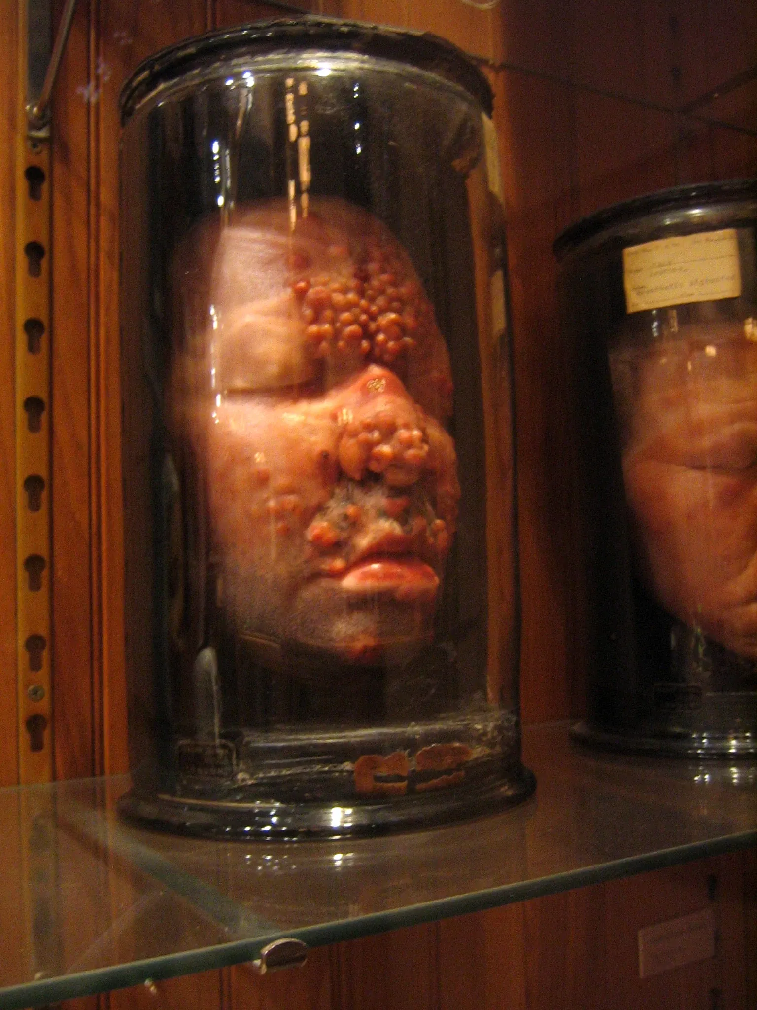 Mütter Museum