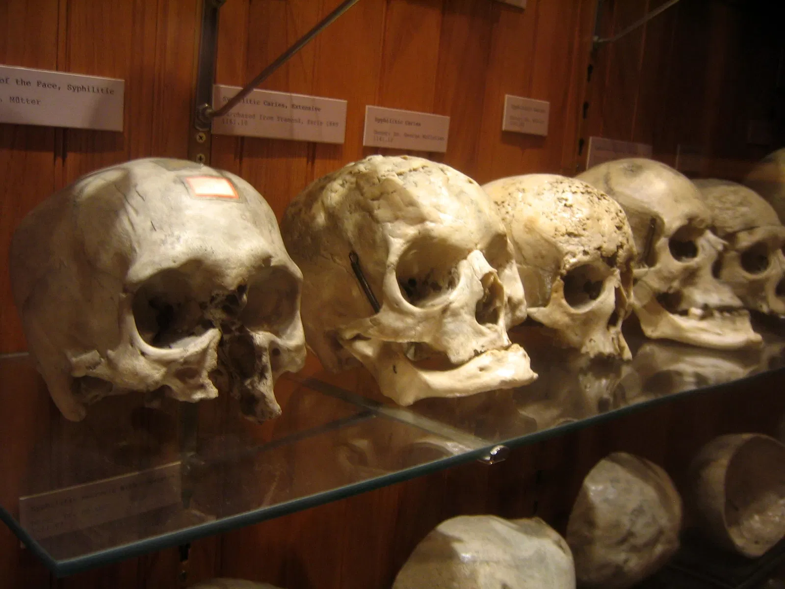 Mütter Museum