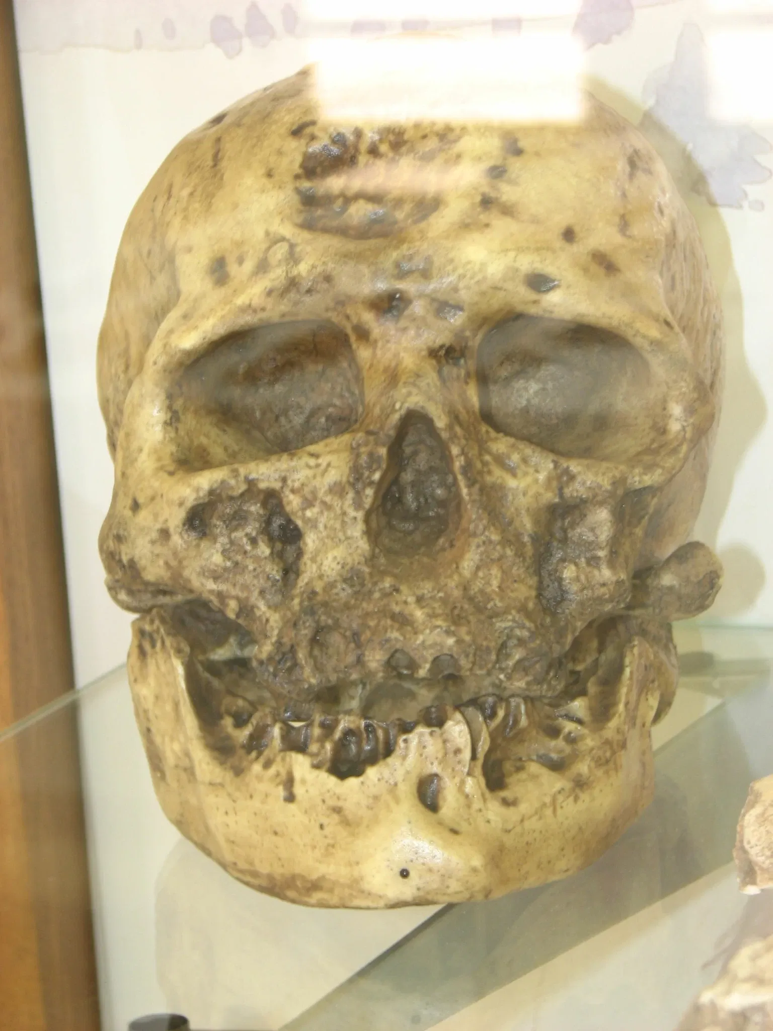 Musée d'archéologie de Catalogne (Gérone)