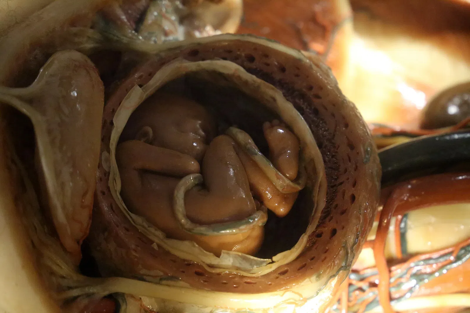 Museo delle Cere Anatomiche