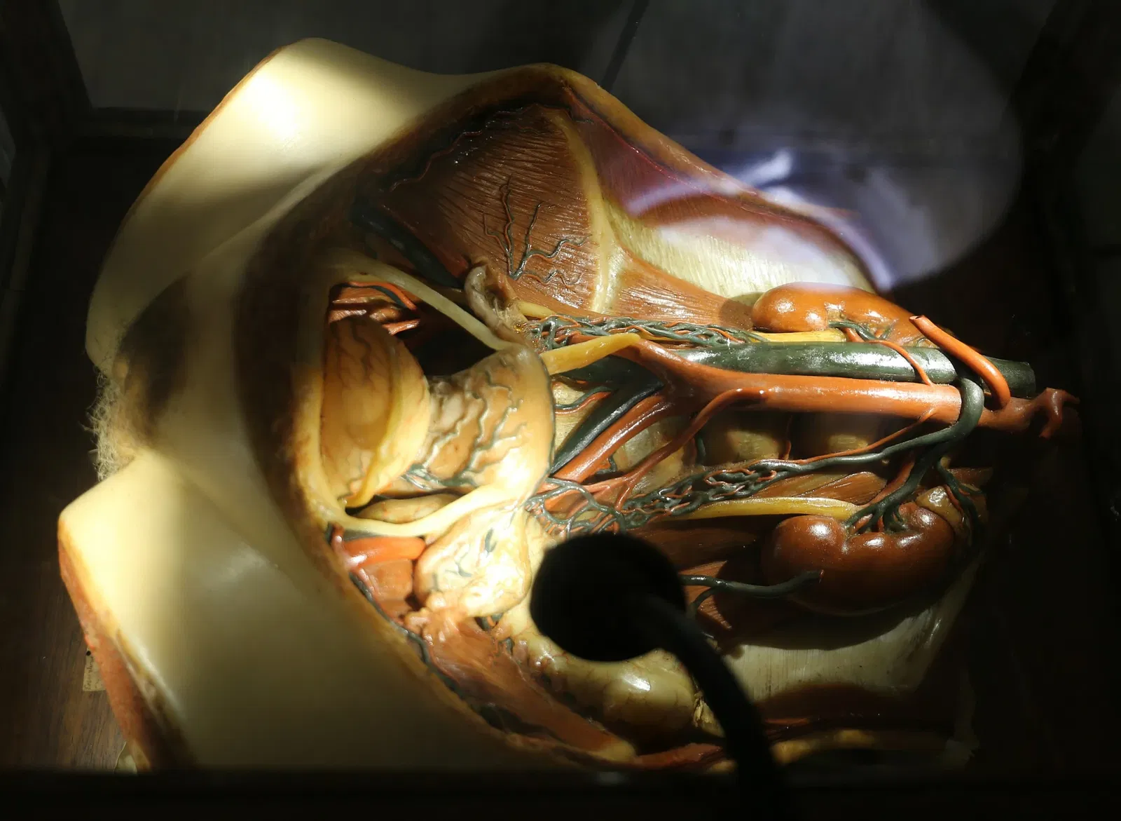 Museo delle Cere Anatomiche