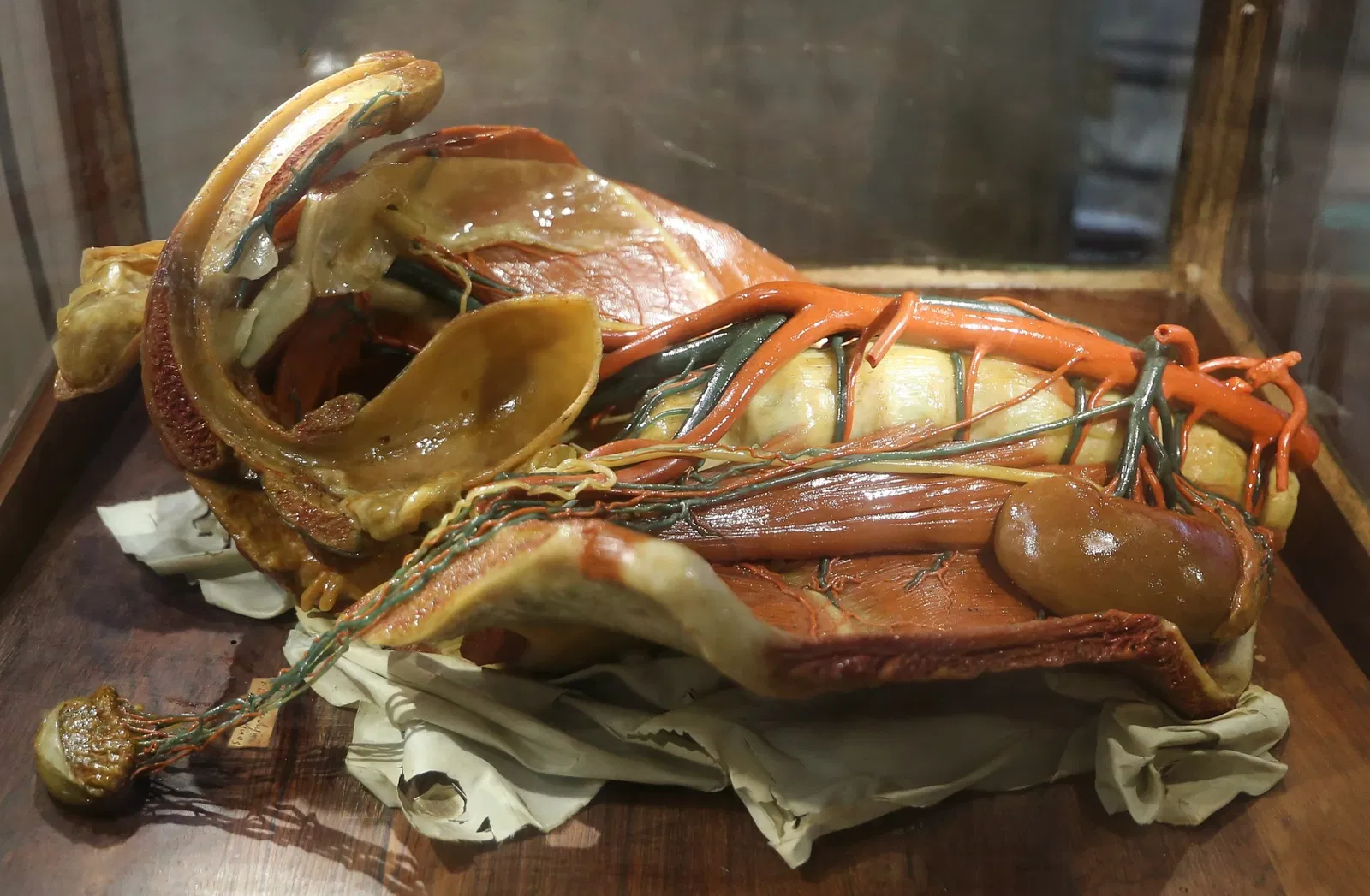 Museo delle Cere Anatomiche