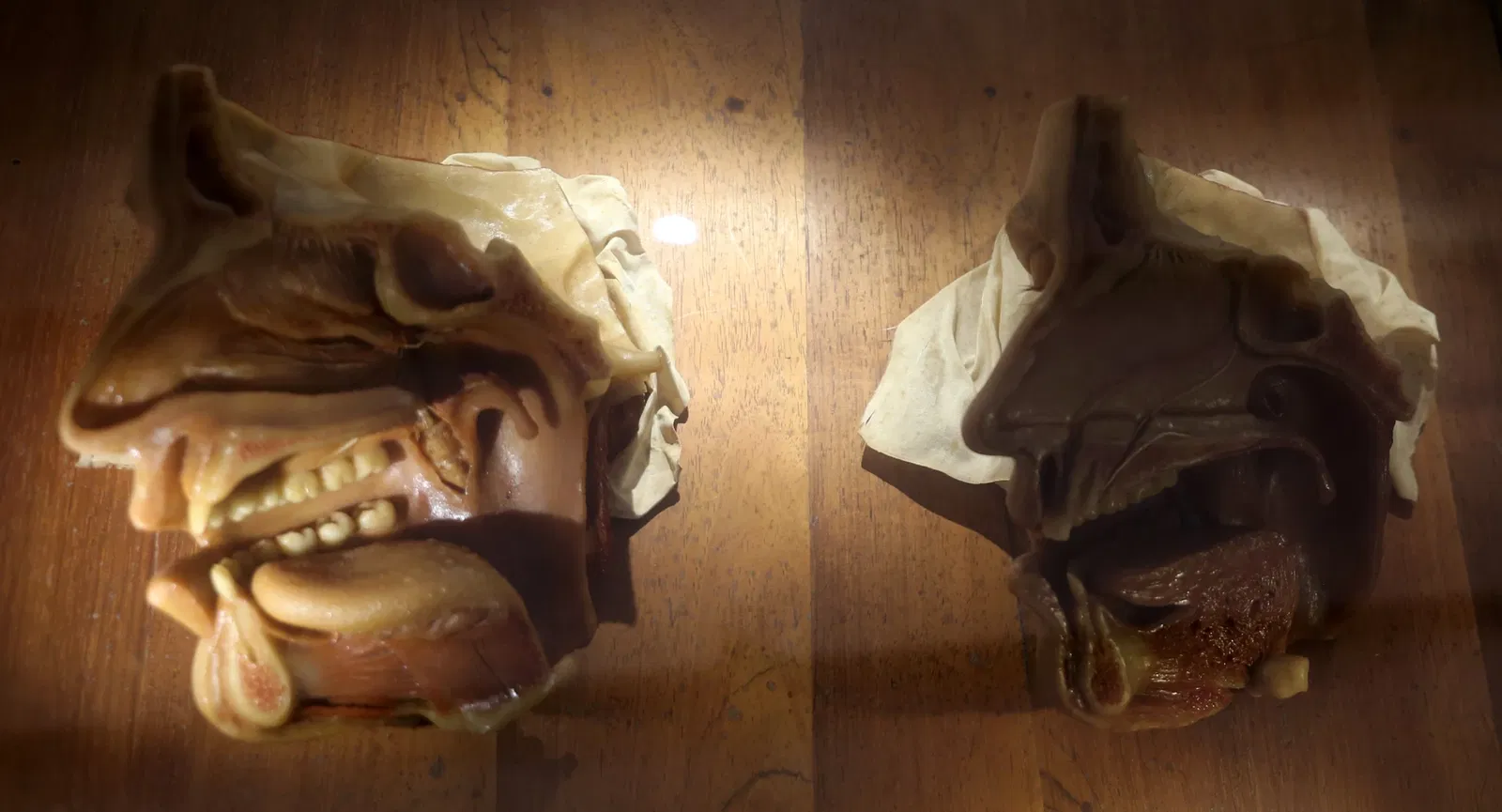 Museo delle Cere Anatomiche