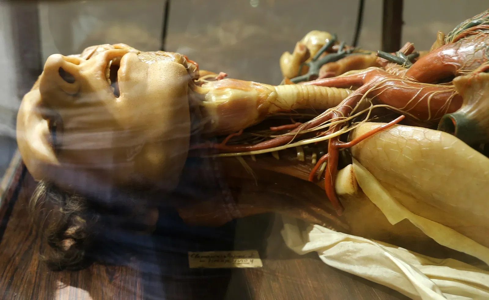 Museo delle Cere Anatomiche