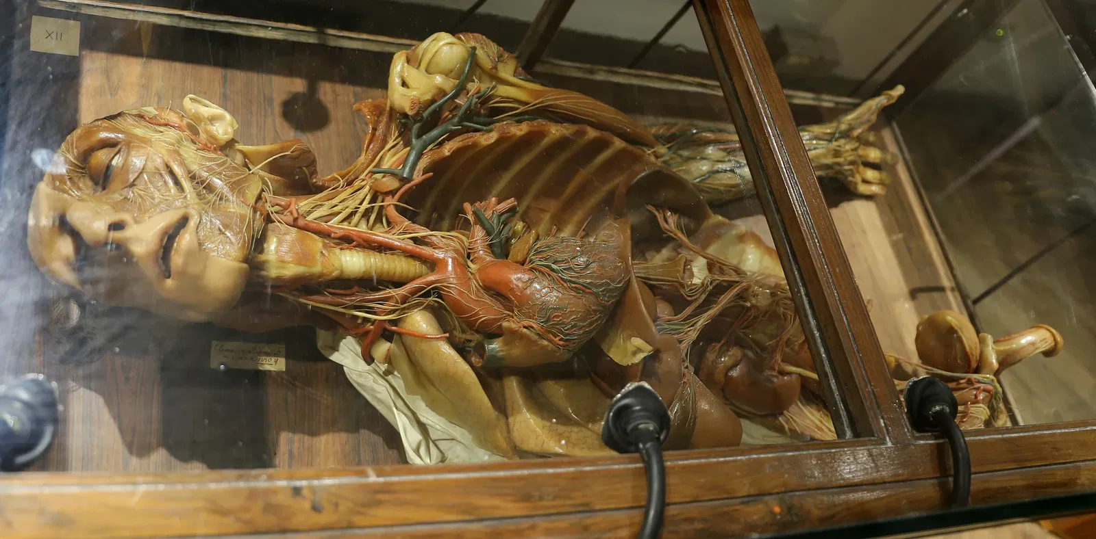 Museo delle Cere Anatomiche