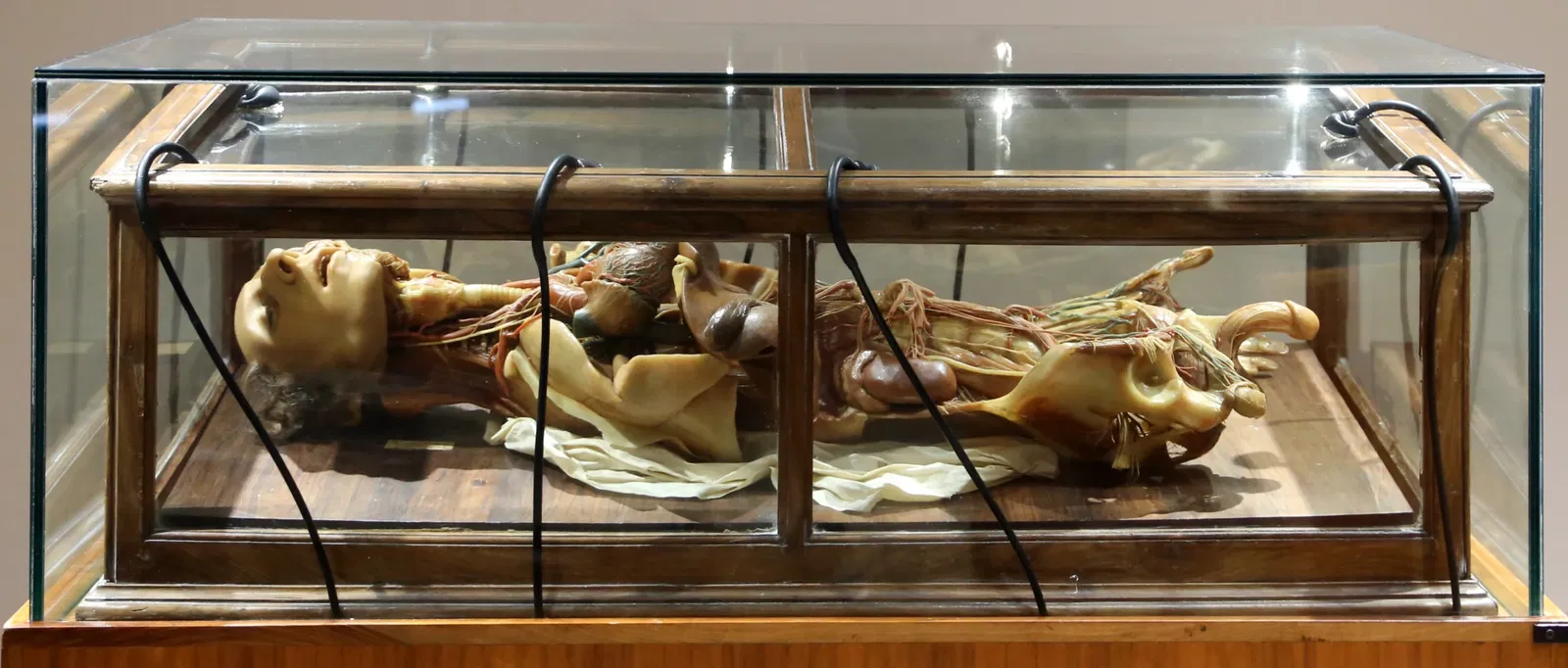 Museo delle Cere Anatomiche