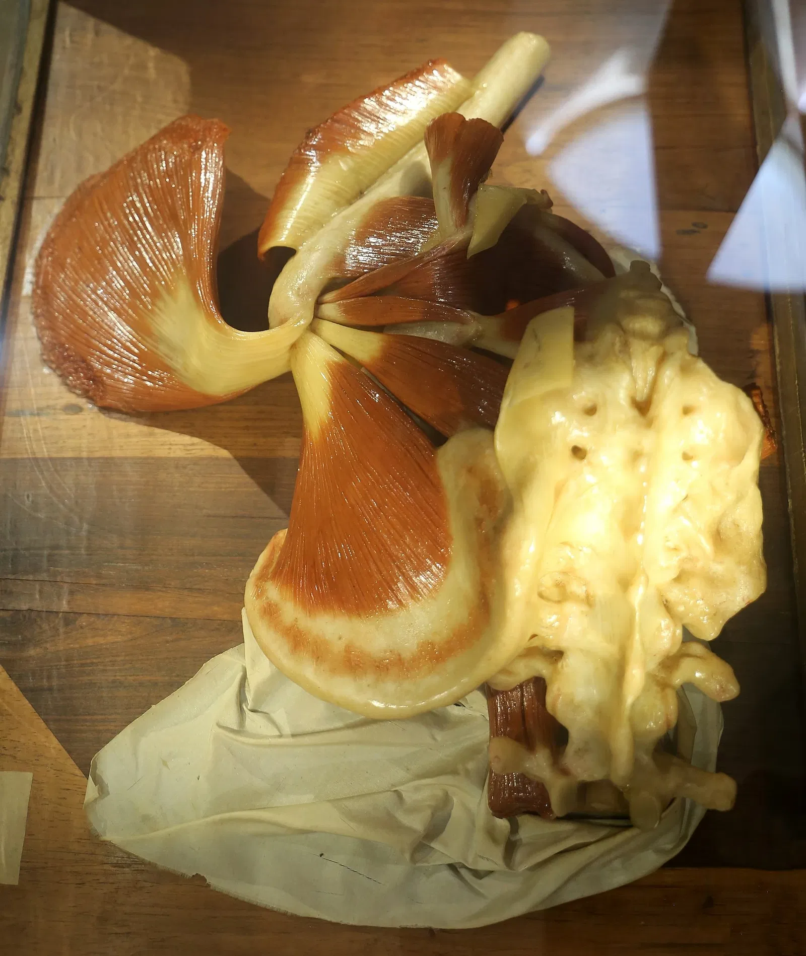 Museo delle Cere Anatomiche