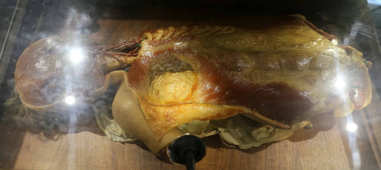 Museo delle Cere Anatomiche