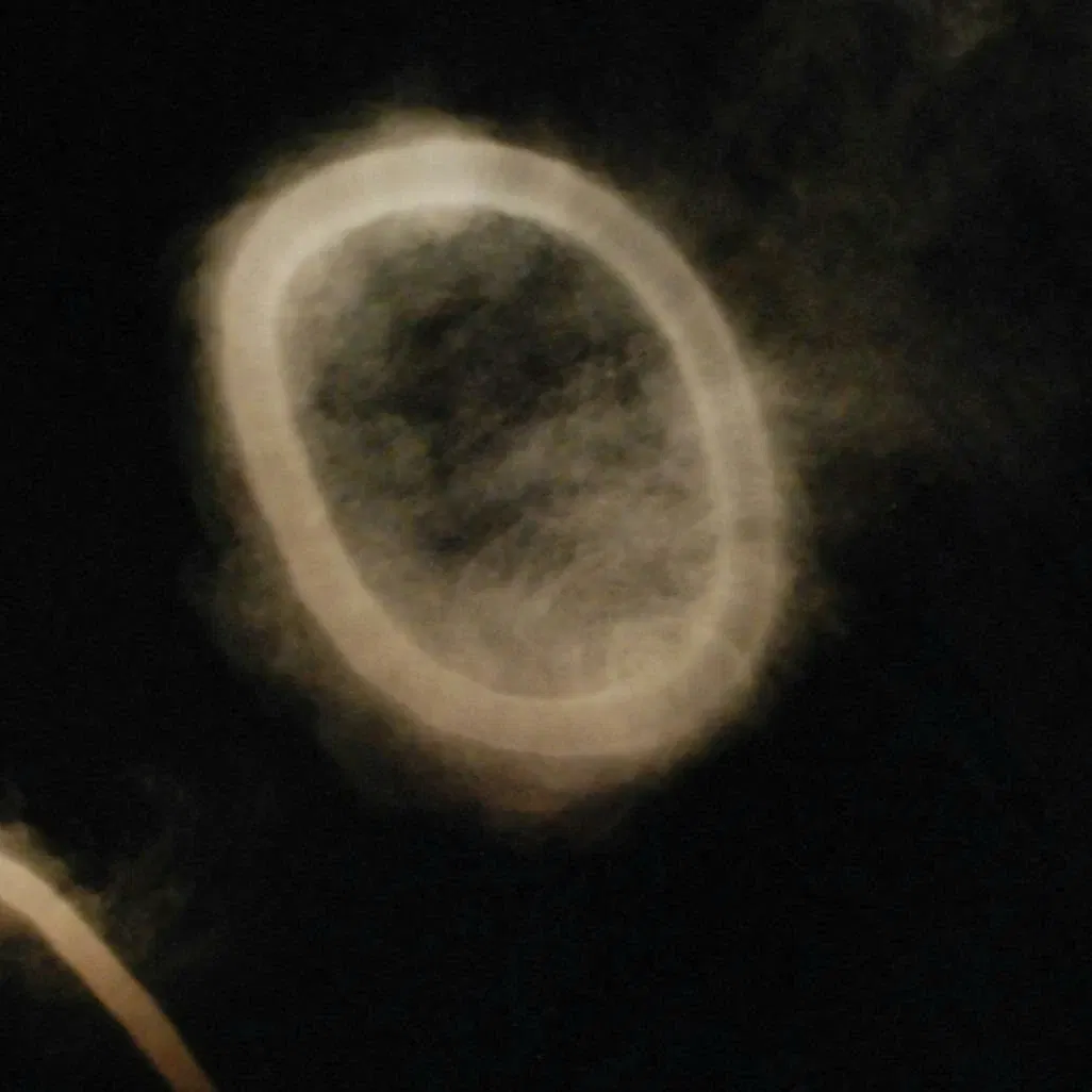 The Silence of Particles