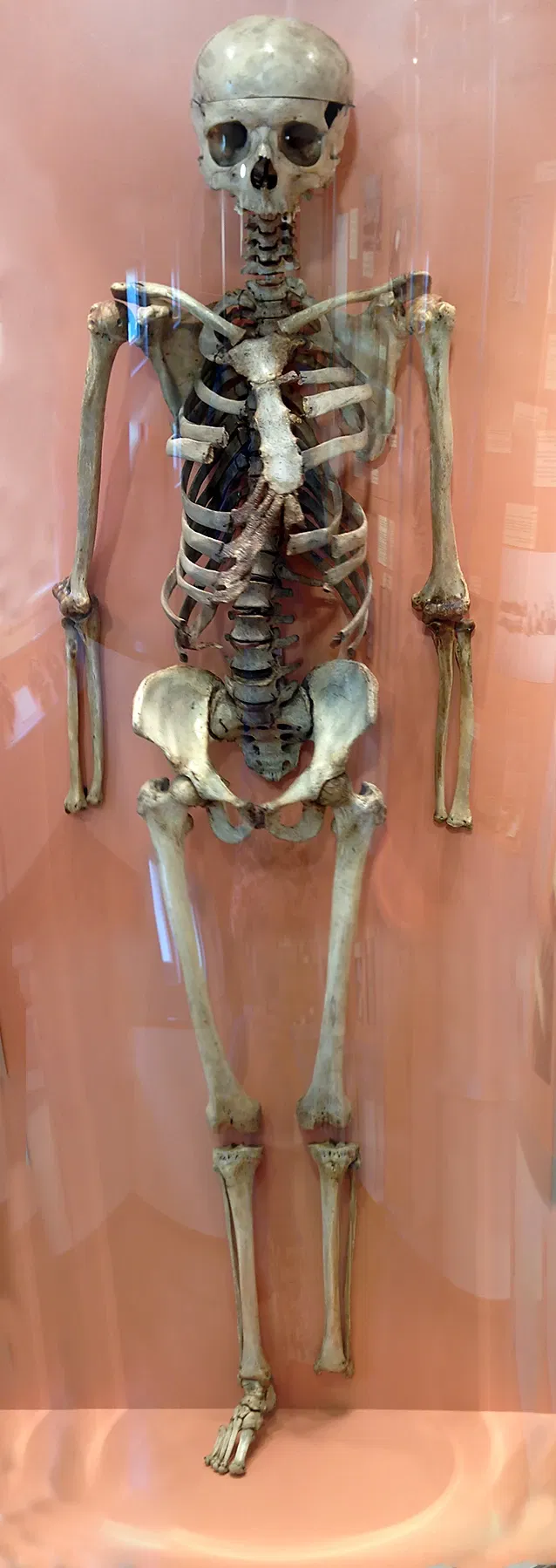 Anatomisches Museum der Universität Basel