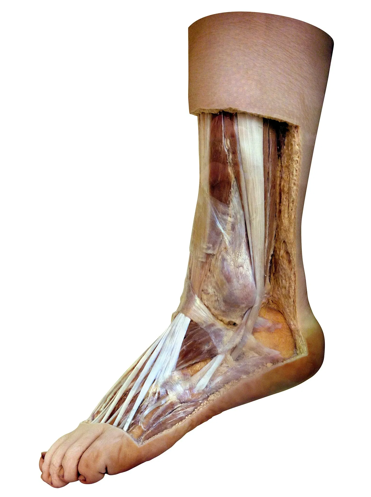 Anatomisches Museum der Universität Basel