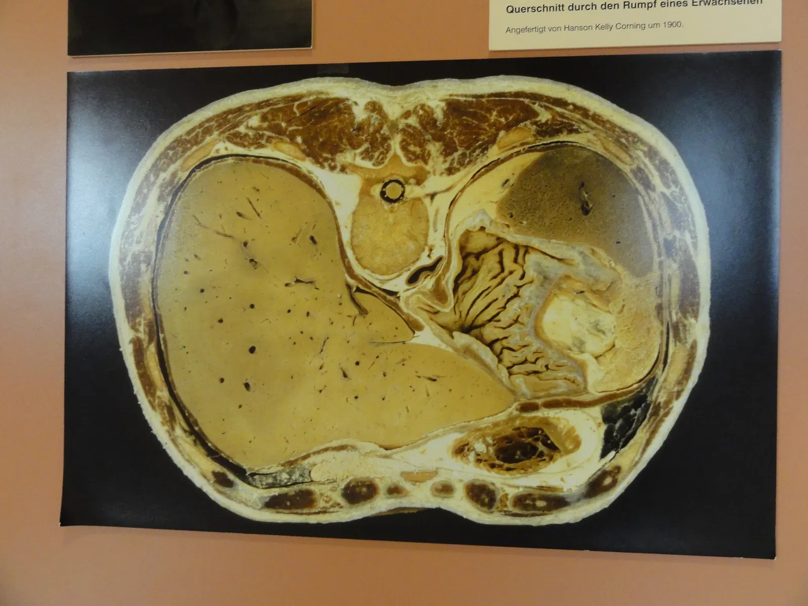 Anatomical Museum of the University of Basel