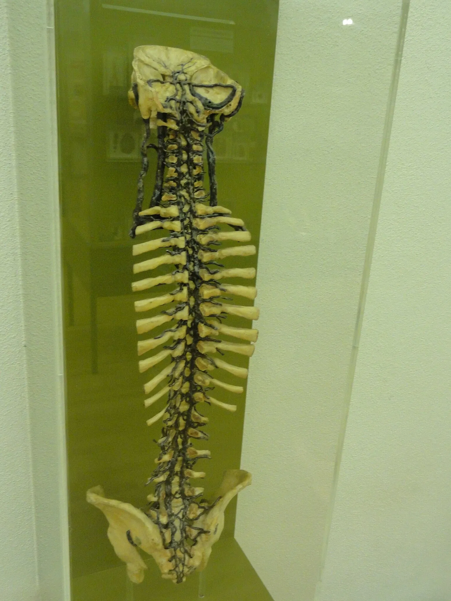 Anatomical Museum of the University of Basel