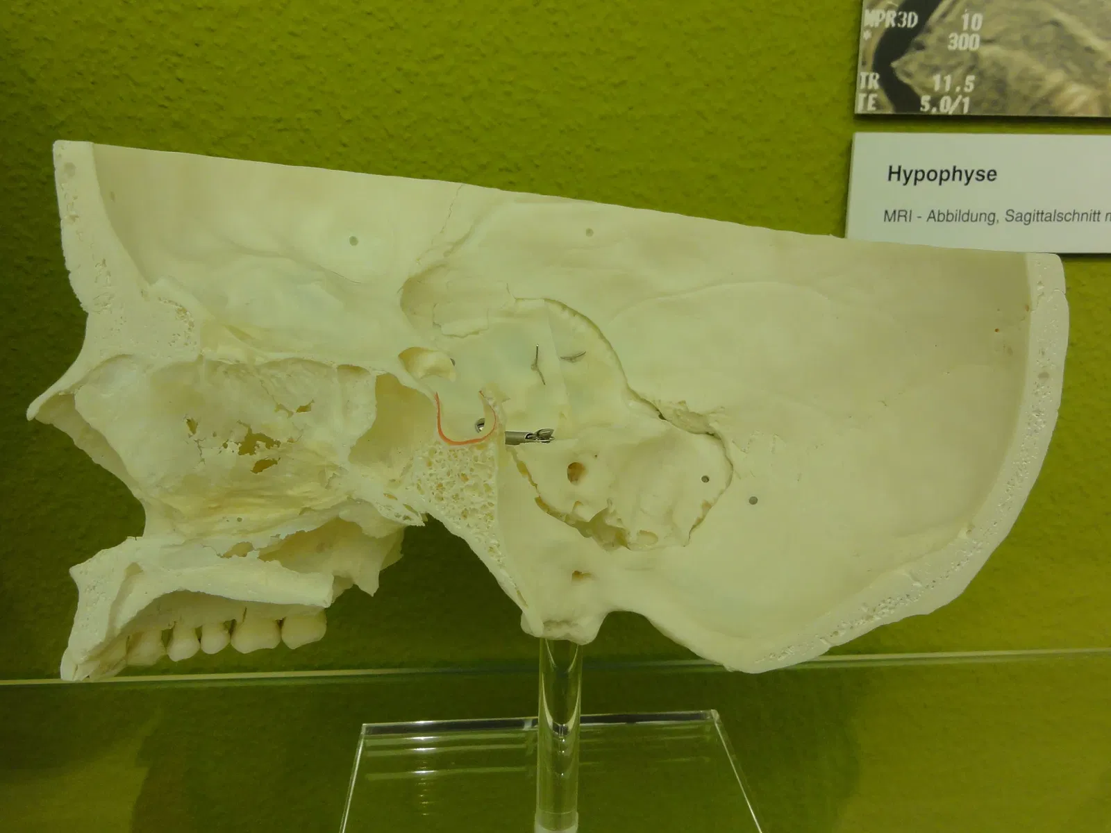 Anatomisches Museum der Universität Basel