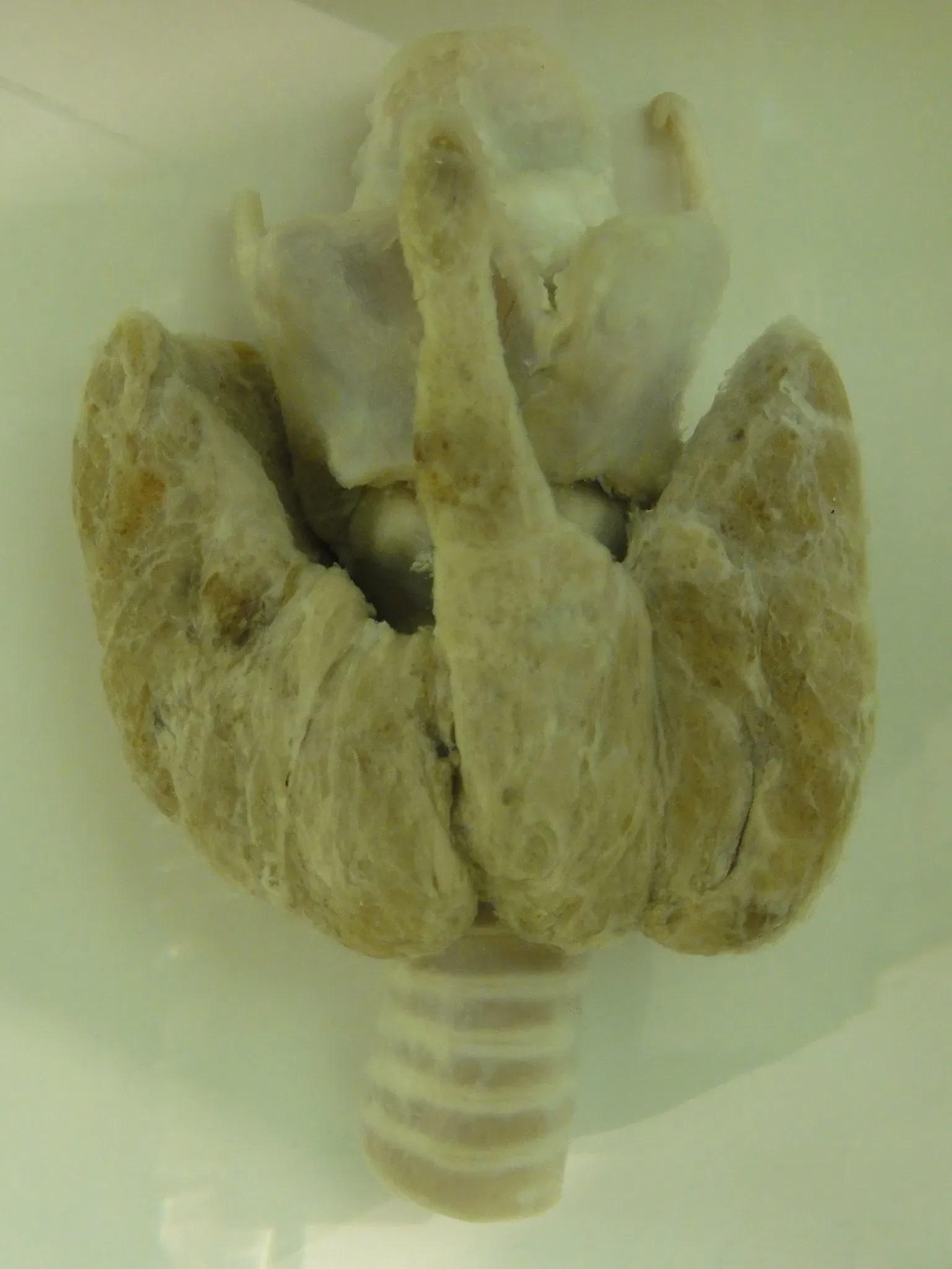 Anatomical Museum of the University of Basel