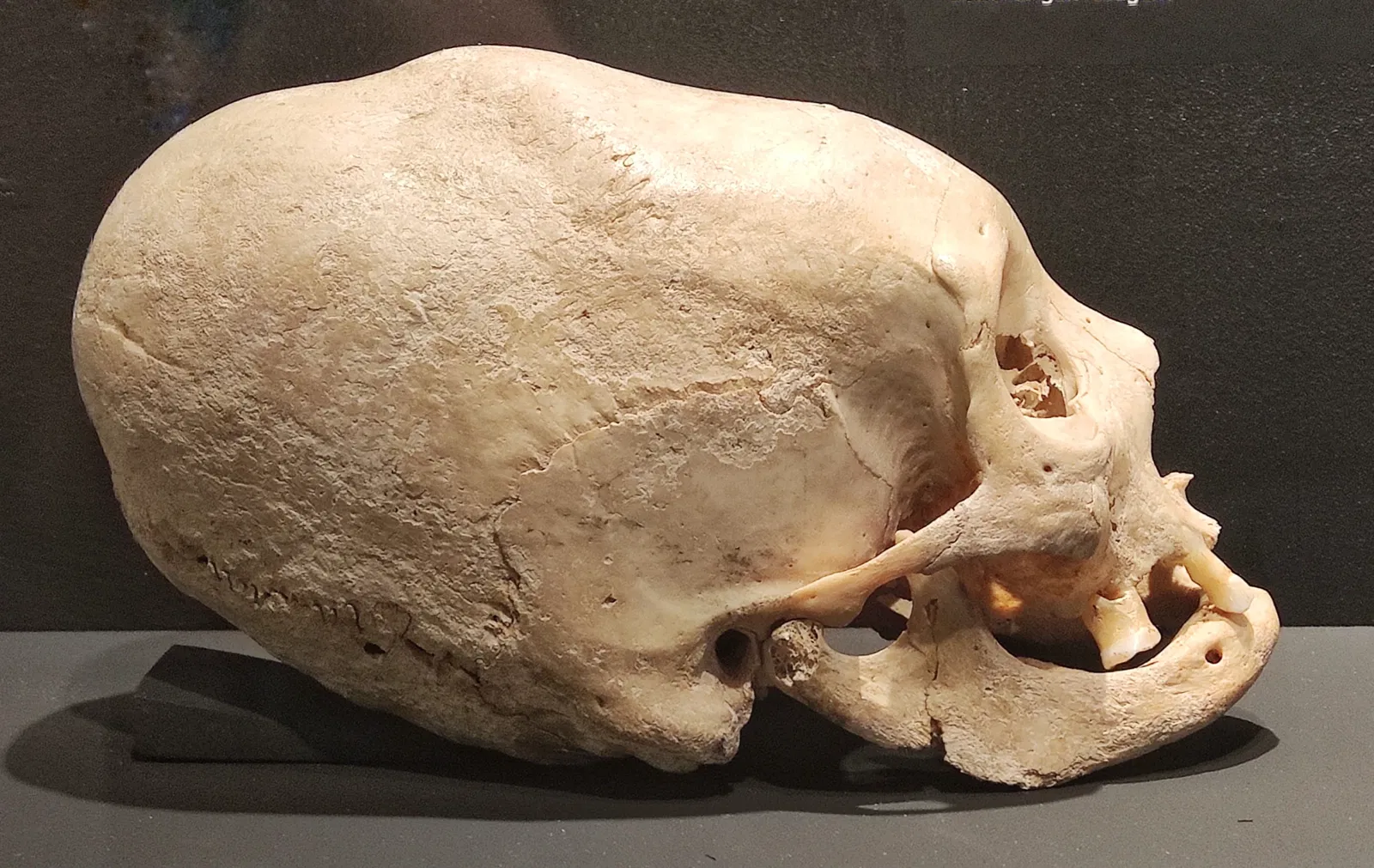 Kurpfälzisches Museum