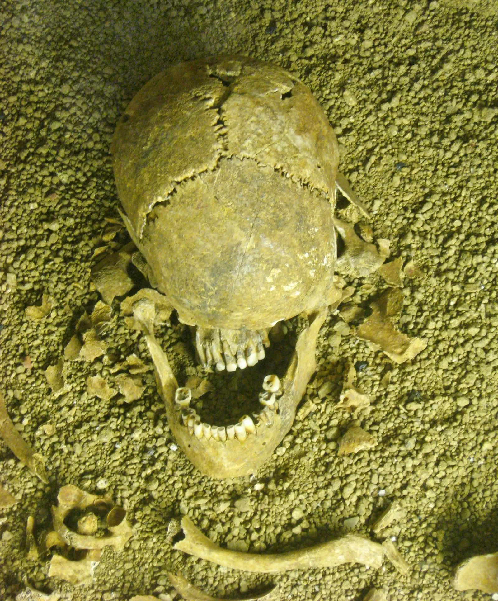 Römermuseum Pachten