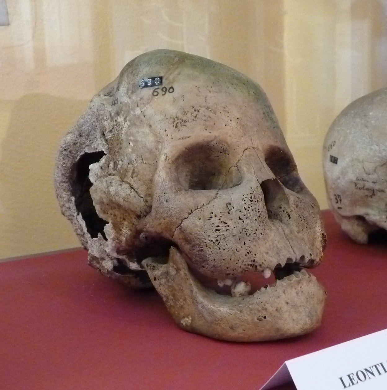 Museo di Antropologia