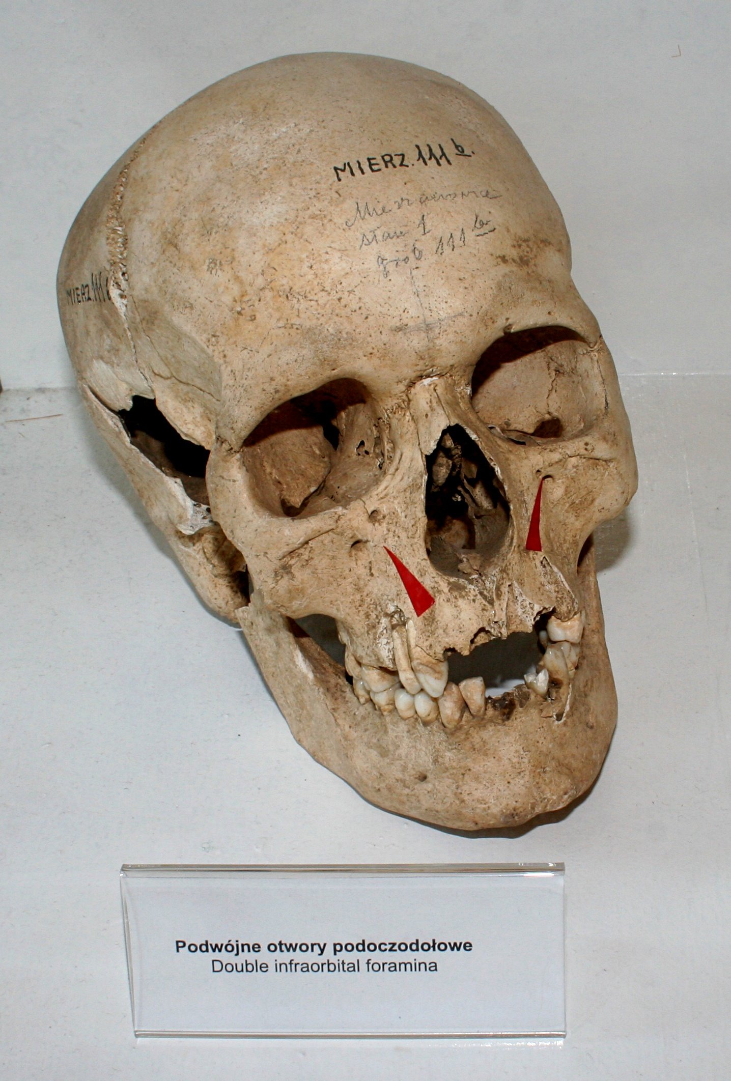 Archeological Museum in Gdańsk