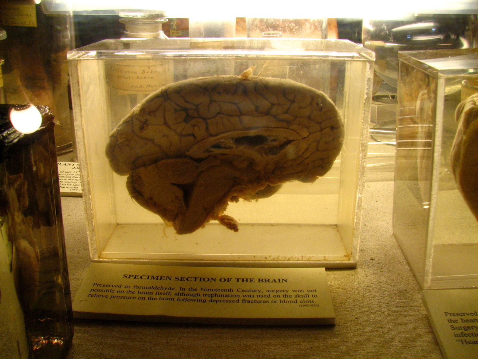 Old Operating Theatre Museum