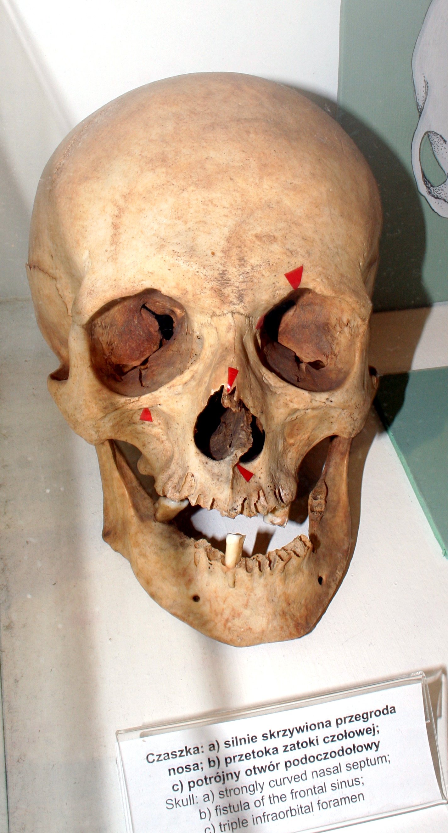 Museum of Archeology