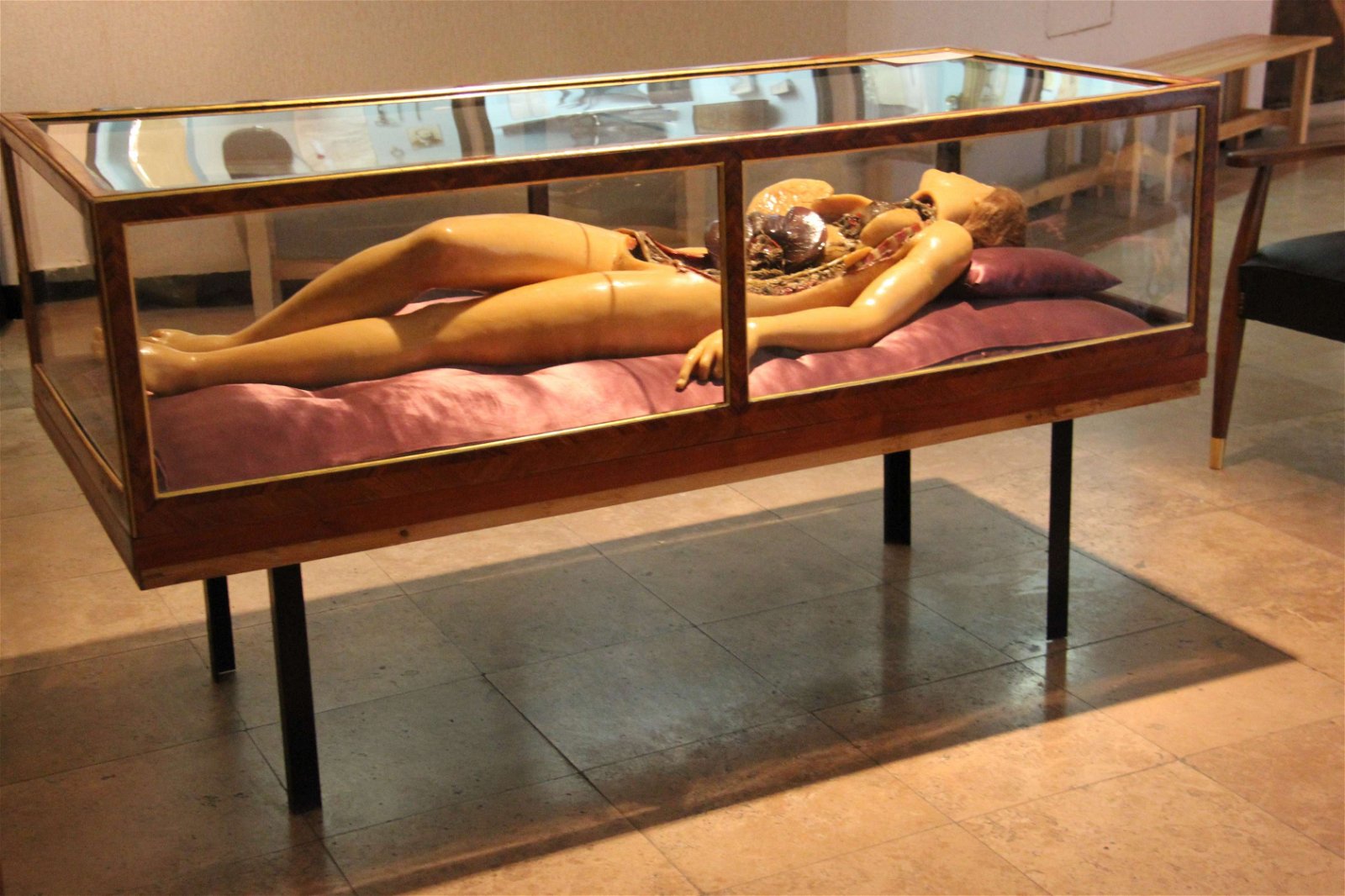 Semmelweis Museum of Medical History