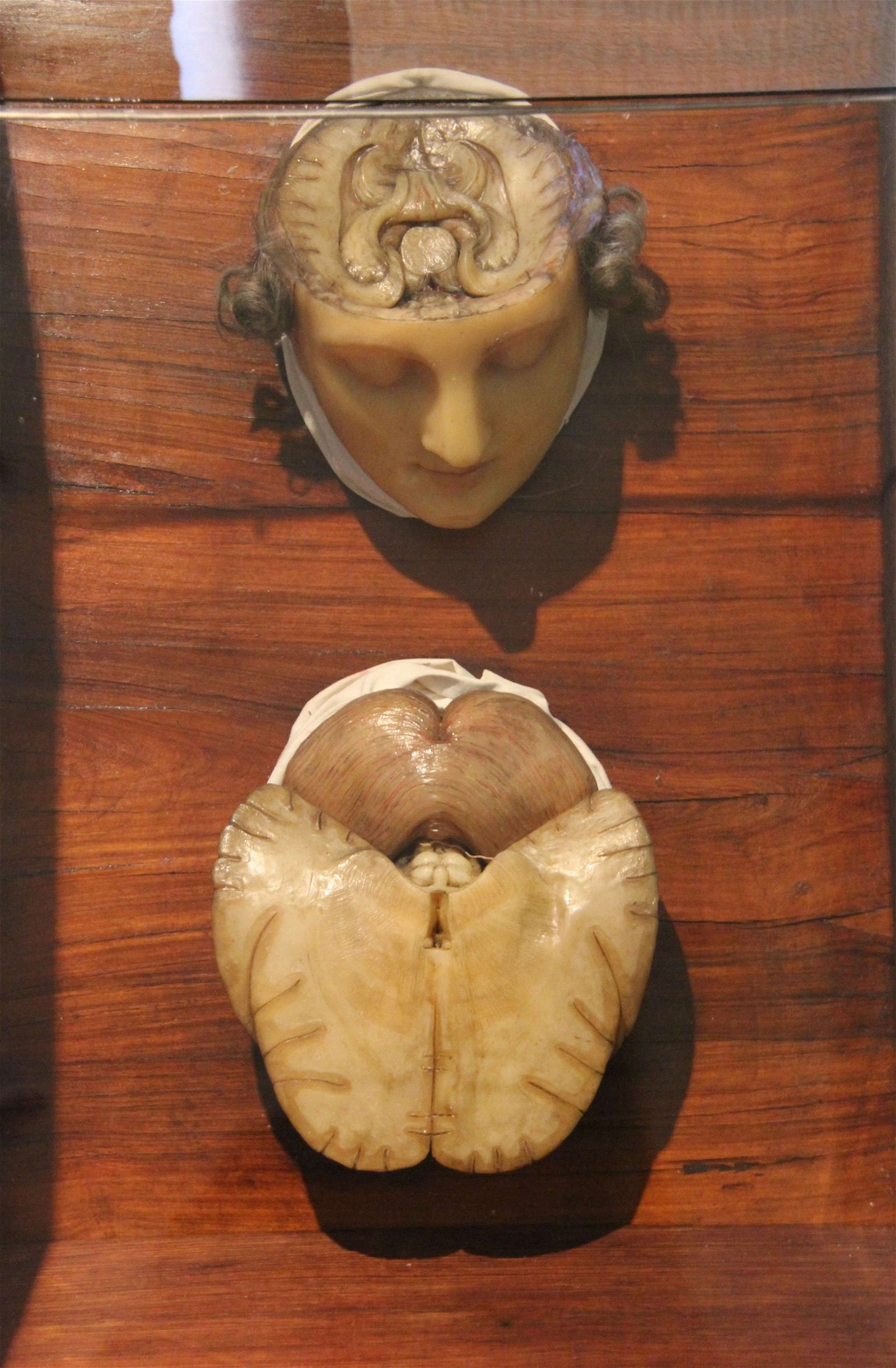 Semmelweis Museum of Medical History