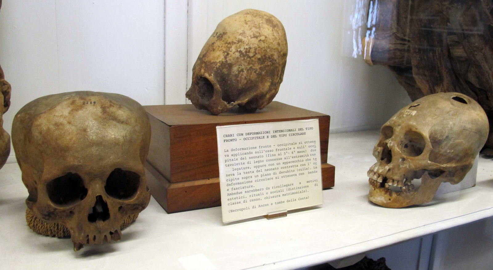 Museo Nazionale di Antropologia e Etnologia