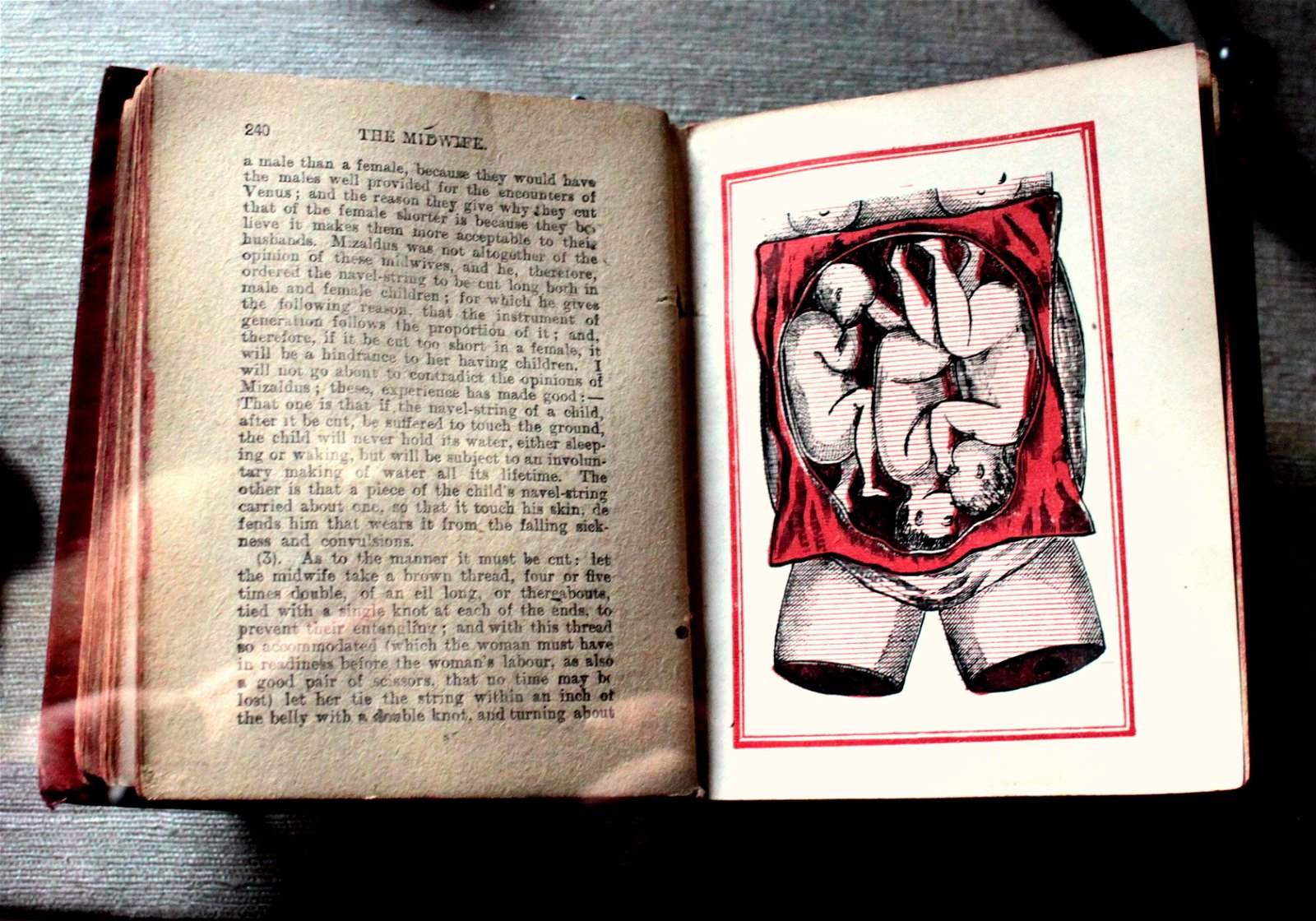 Old Operating Theatre Museum