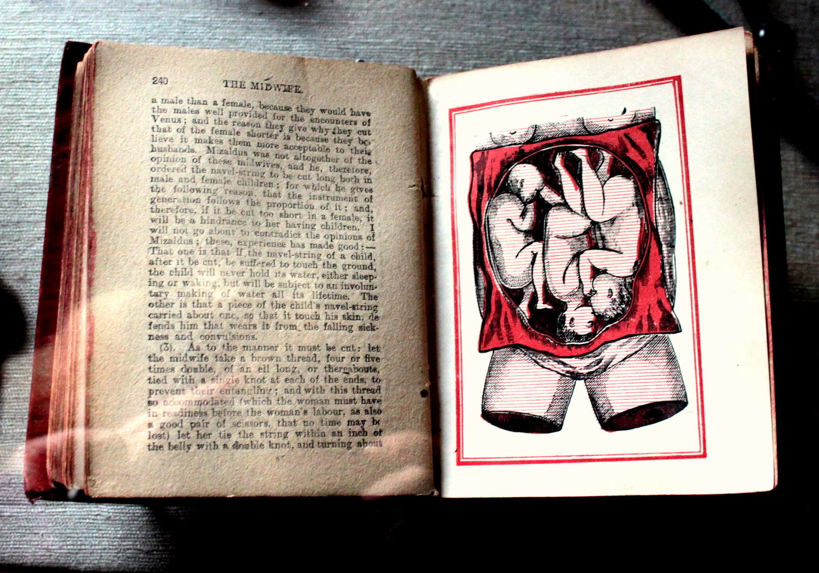 Old Operating Theatre Museum